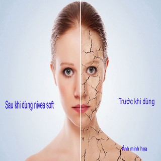 Kem dưỡng ẩm Nivea Soft Đức