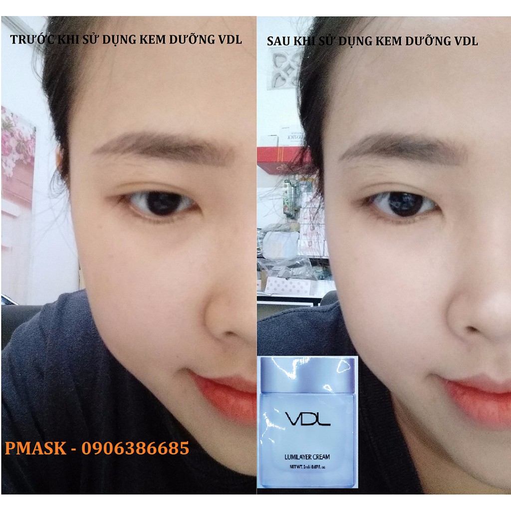 Kem dưỡng trắng da VDL Lumilayer Cream 2ml