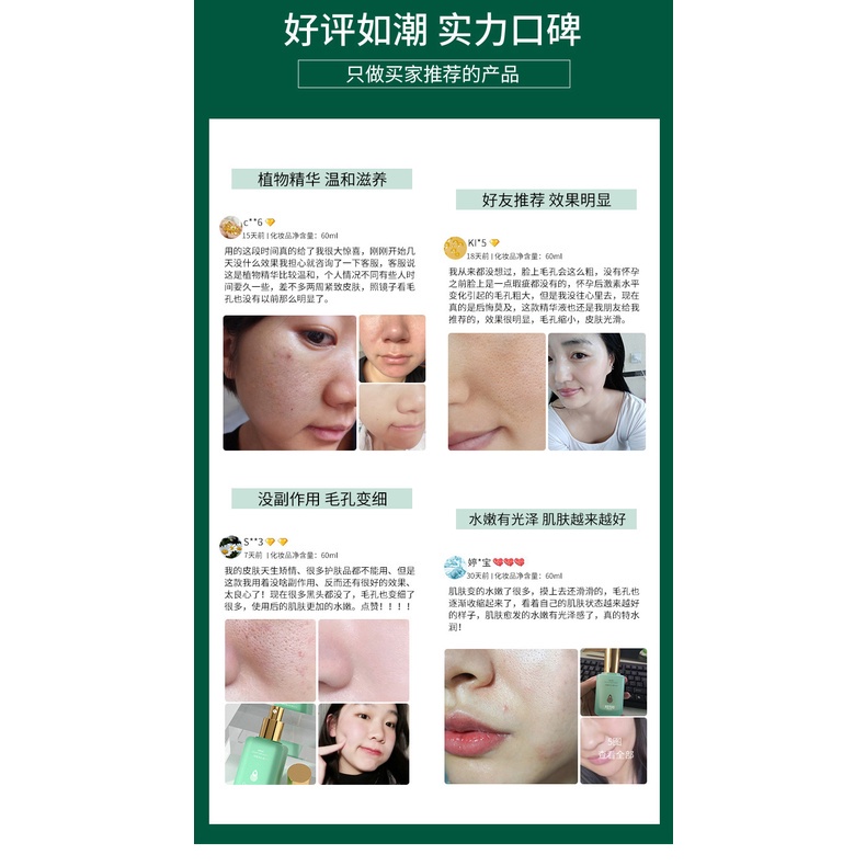 Serum dưỡng ẩm Heyxi Kem se khít lỗ chân lông mịn da sáng da Morasa Beauty HX08