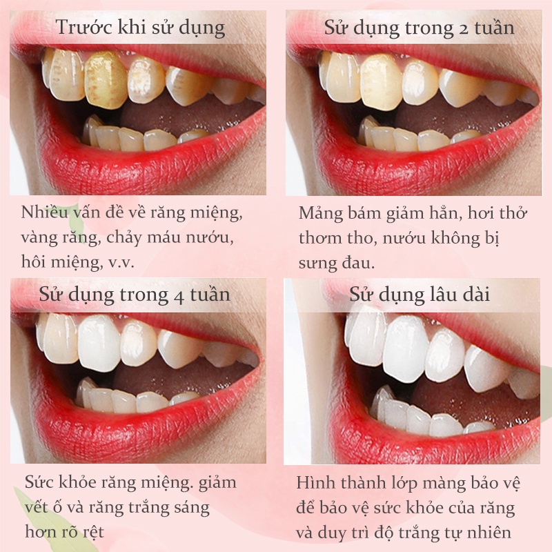 [HCM][KissBeautyShop] RtopR Bọt Trắng Răng Làm Sạch Răng Khử Mùi Hôi Miệng Làm Trắng Răng Làm Trắng Răng 60ml KB-RR044