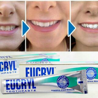 Kem tẩy trắng răng Eucryl