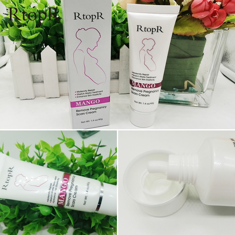 [HCM] RtopR Kem xoài rạn da cho phụ nữ mang thai loại bỏ sẹo chống lão hóa làm săn chắc da-KB-RR027