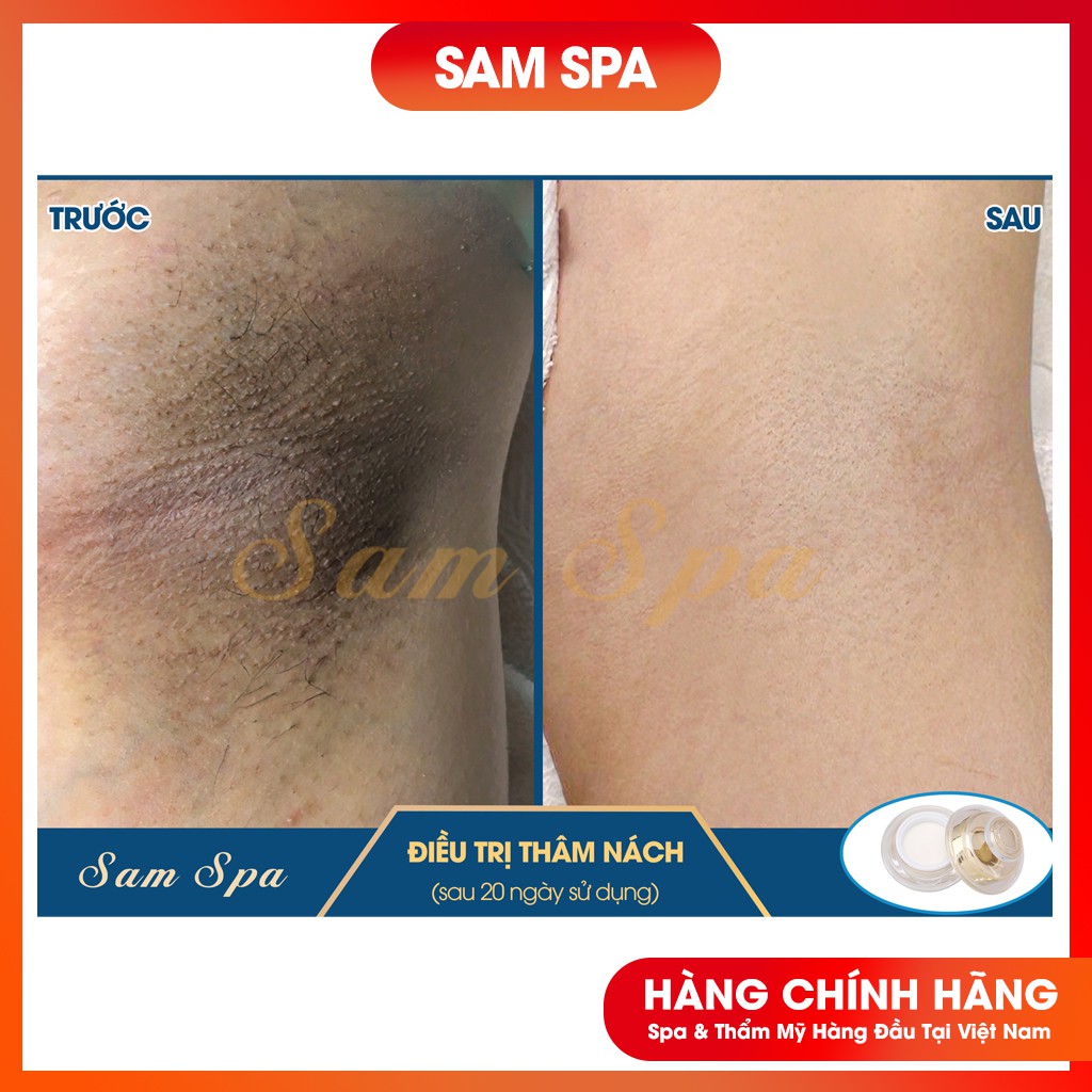 Kem Mờ Thâm Nách, Kem Mờ Thâm Bẹn Hàng Chuẩn Spa 30gr