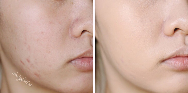 Phấn nước L'Oréal Paris True Match Lumi Cushion Foundation tone C3 Creamy Natural 14,6gr