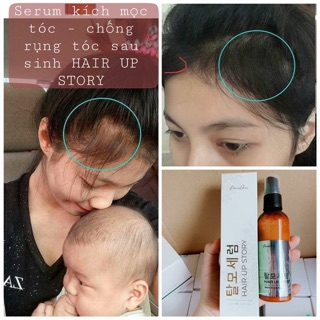 Xịt mọc tóc genie