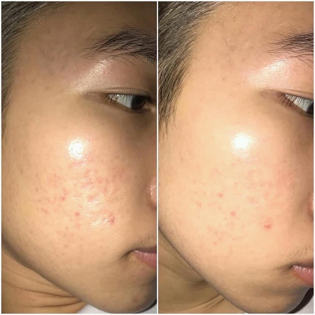 Kem Sẹo Chính Hãng Scar Esthetique 60ml | BigBuy360 - bigbuy360.vn