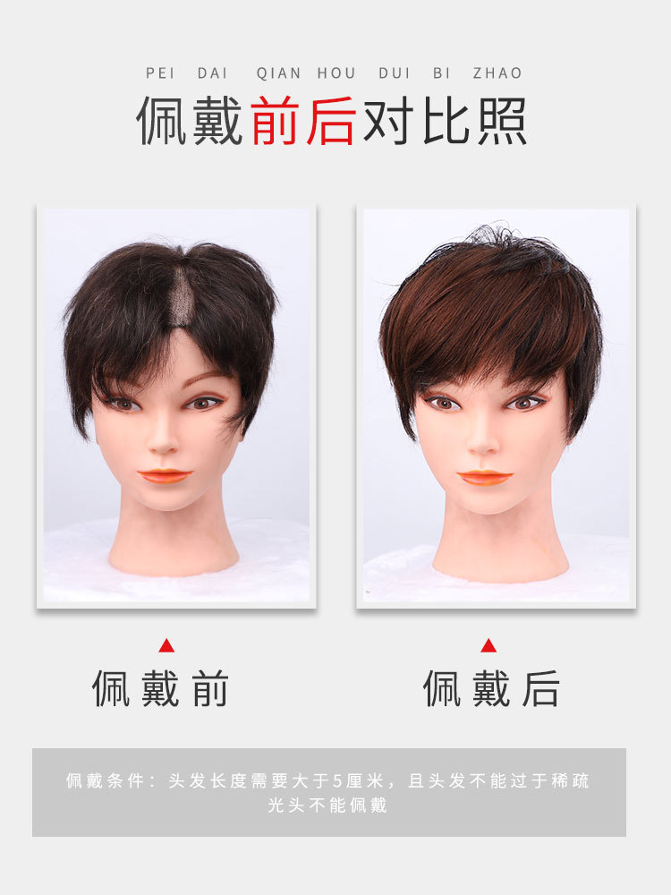 【feibin wig】Tóc mái giả, con trai che trán, tóc giả, tóc bổ sung cho nam, đường viền trán, tóc giả và thay đầu