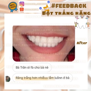 Liệu Trình Siêu Trắng Răng