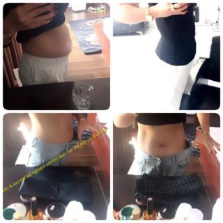 KEM TAN MỠ DR.LACIR VÀ GEL NỊT BỤNG DR.SLIM