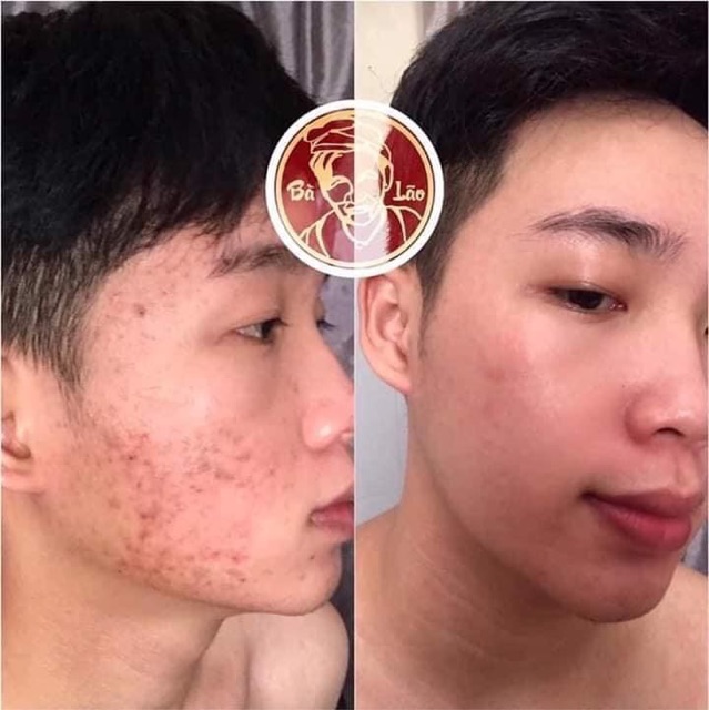 Serum Tái Tạo - Tái Tạo Cao Cấp Bà Lão