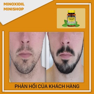 Viên uống Folic mọc Râu Tóc