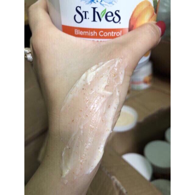 [ Chính Hãng] Tẩy Tế Bào Chết Toàn Thân ST IVES - 283g | BigBuy360 - bigbuy360.vn