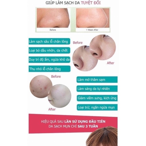 Sữa rửa mặt Avène Pháp tuýt 200ml hàng Pháp