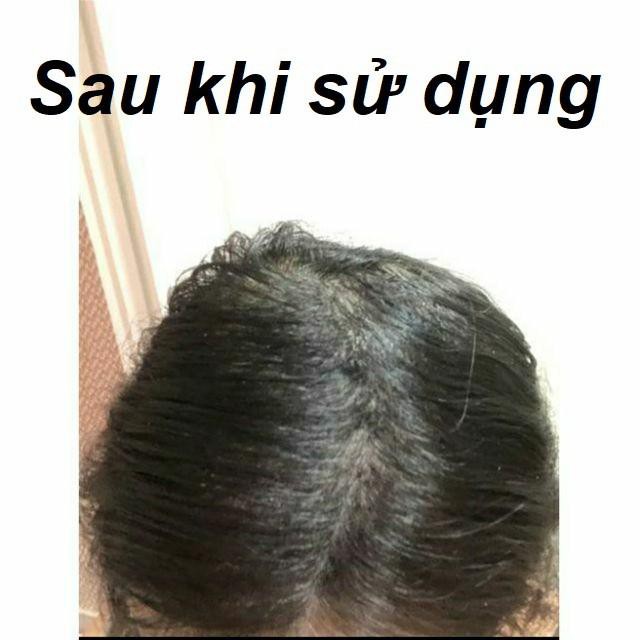 [Bán Sỉ] Bột phủ dày tóc Toppik Hair