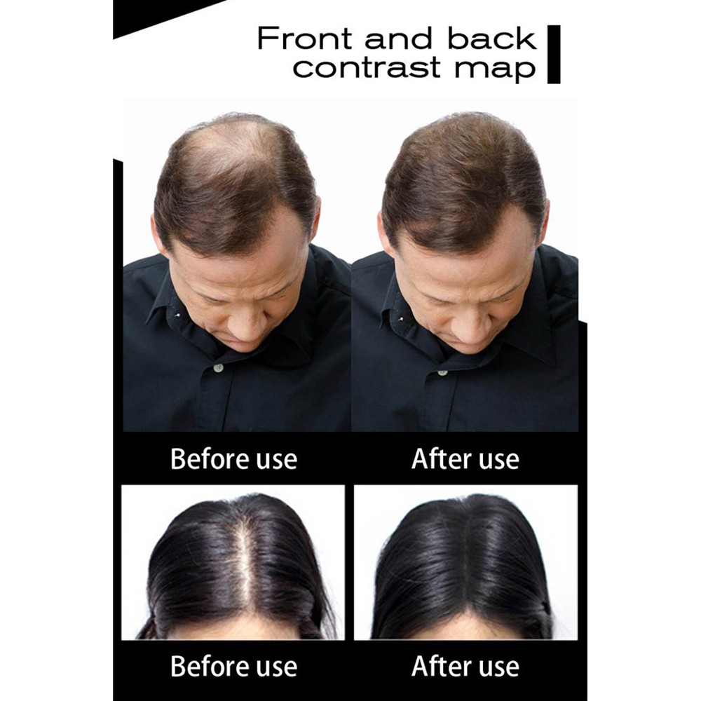 (Hàng Mới Về) Bình Xịt Làm Dày Tóc Sevich Tạo Kiểu Chuyên Dụng | BigBuy360 - bigbuy360.vn