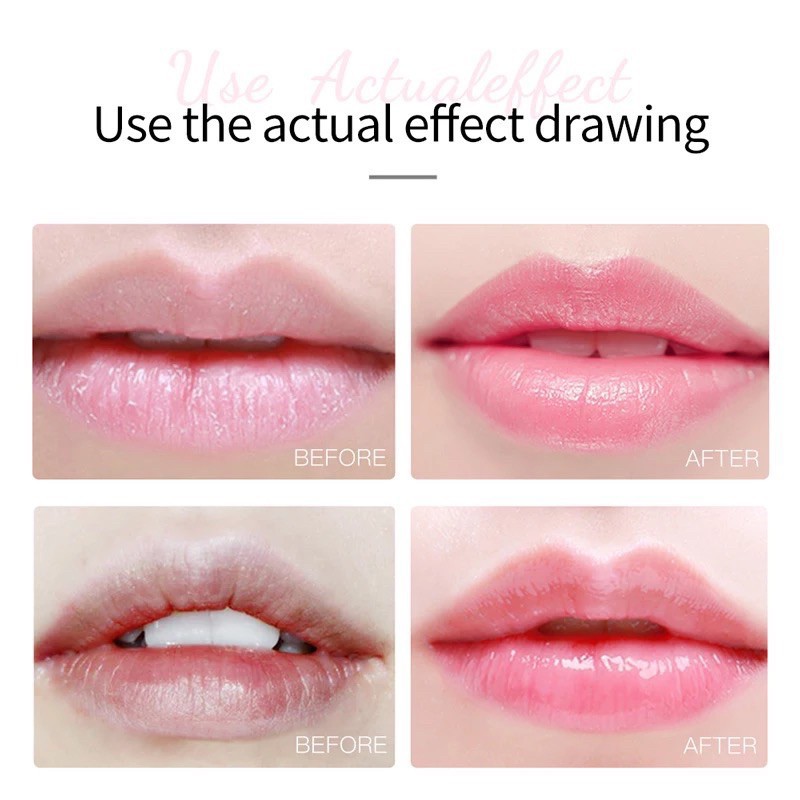 (Hàng Mới Về) Mặt Nạ Môi Zozu Chiết Xuất Cherry Dưỡng Ẩm | BigBuy360 - bigbuy360.vn