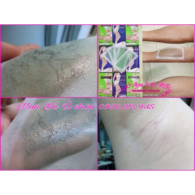 Combo 5 hộp dán wax lông