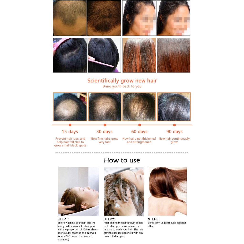 Tinh chất dưỡng tóc gốc Andrea nguyên chất đậm đặc chống rụng tóc Liquid Essence Oil 20ml