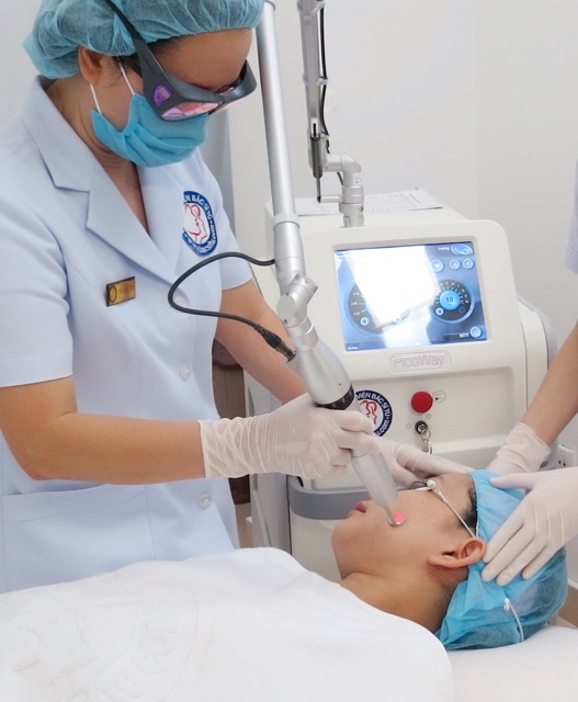 máy laze trục khuỷ PICOWAY