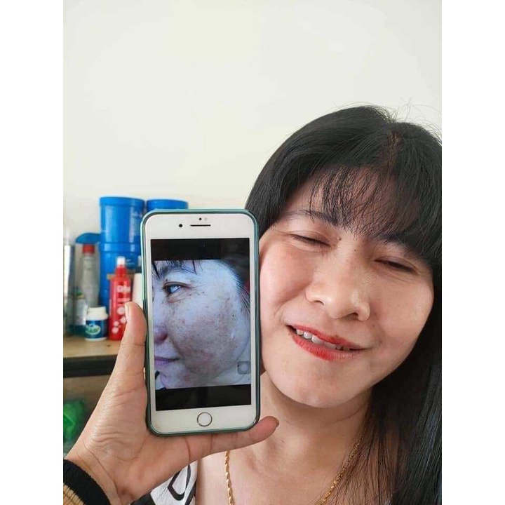 Serum tái tạo da Yody White Phương Anh 80ml dành cho da mụn nám tàn nhang sẹo rỗ da không đều màu