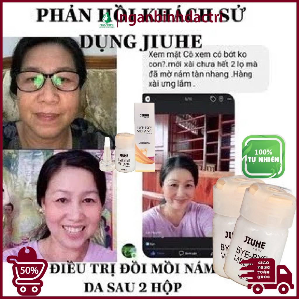 Serum tri thâm hàn quốc JIUHE Q-PEARL giảm thâm do mụn khửu tay chân, thâm sẹo, thâm nách hiệu quả