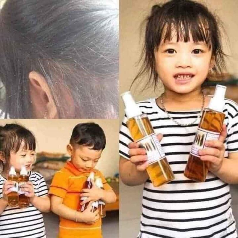 Dầu gội diệt chấy chí 150ml , sạch ngay từ lần sử dụng đầu tiên