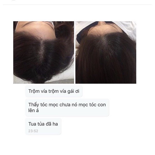 Tinh dầu bưởi kích thích mọc tóc dạng xịt | BigBuy360 - bigbuy360.vn