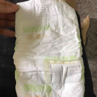 Bỉm (tã dán) HIPGIG  cho bé đủ size  50S/50M