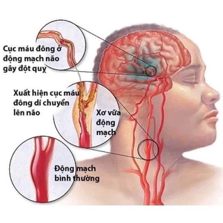 ÍCH THANH TRÀ ( TRÀ ĐÔNG Y DƯỠNG SINH)