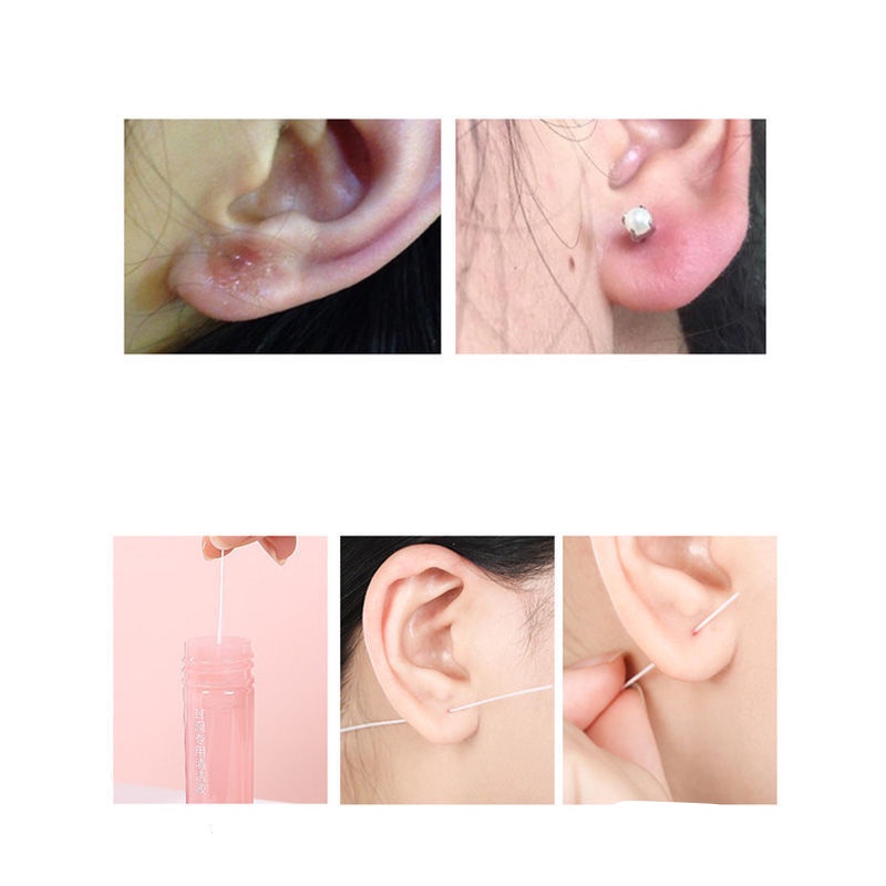 Bộ 70 Dụng Cụ Làm Sạch Lỗ Tai Làm Sạch Lỗ Tai Một Lần Ngăn Chặn Nghẹt Tai