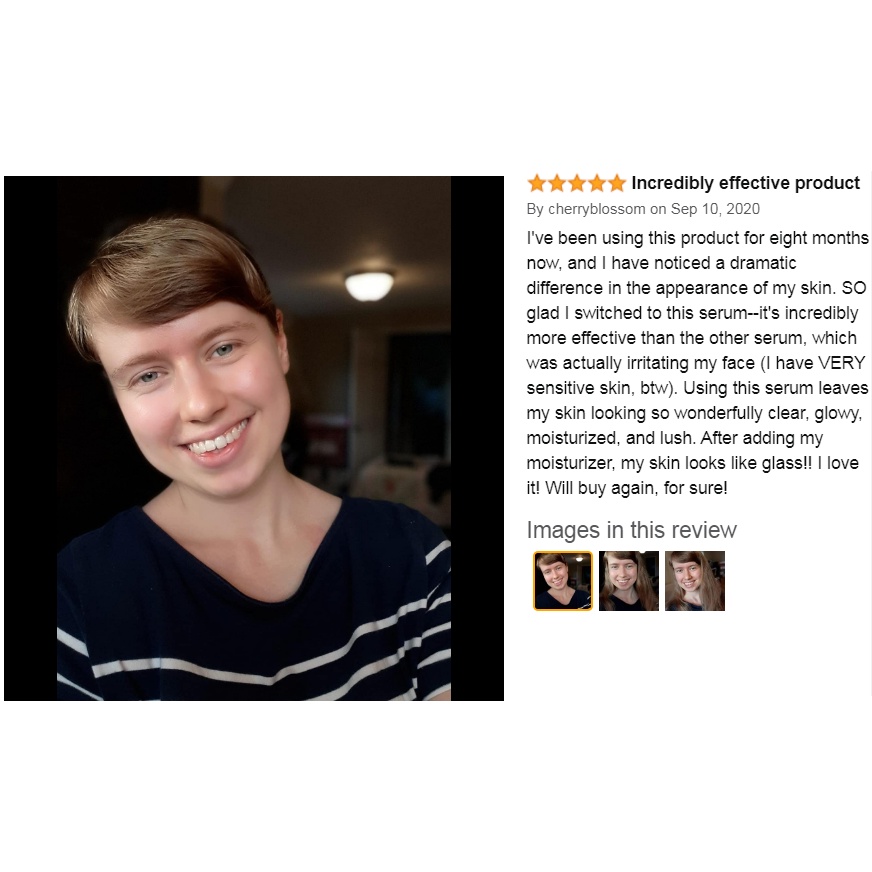 Tinh chất Hyaluronic Acid cấp ẩm căng da thu nhỏ lỗ chân lông cho da dầu khô nhạy cảm