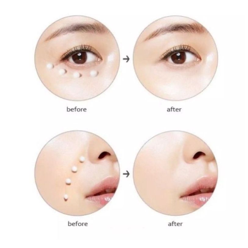 combo 5 gói Kem dưỡng ngăn ngừa thâm nhăn chảy xệ vùng mắt Su:m37° Losec Summa Elixir Eye Cream
