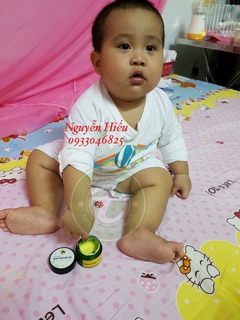 KEM NGHỆ NẾP ĐỎ