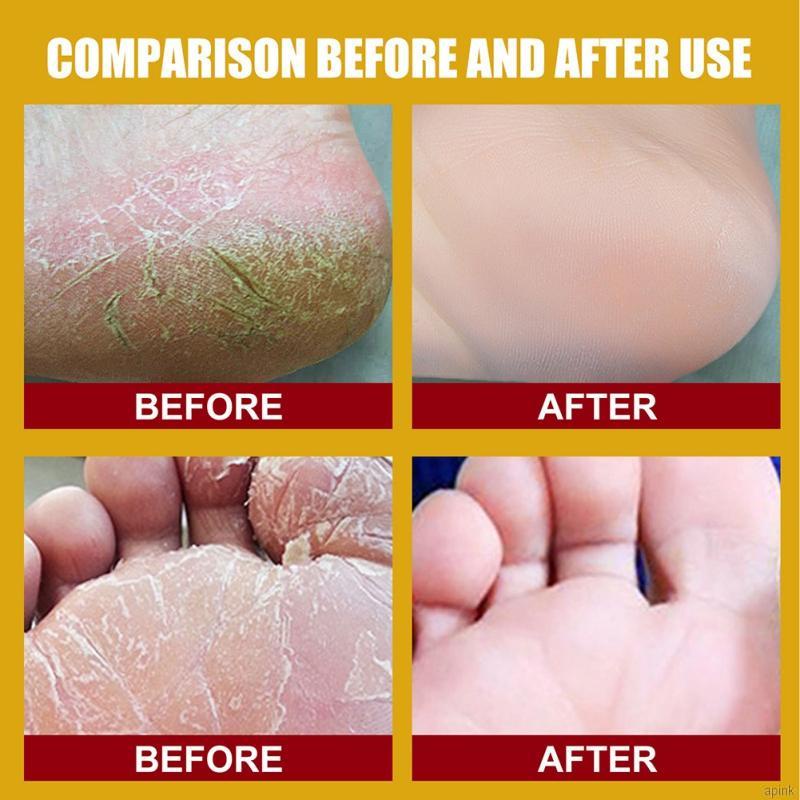 Kem Dưỡng Da Chân Chiết Xuất Từ Chuối Giúp Tẩy Tế Bào Chết Dưỡng Ẩm Chống Nứt Nẻ Da Chân 20g