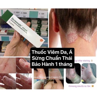 KEM VẢY NẾN,Á SỪNG,VIEM DA THÁI LAN