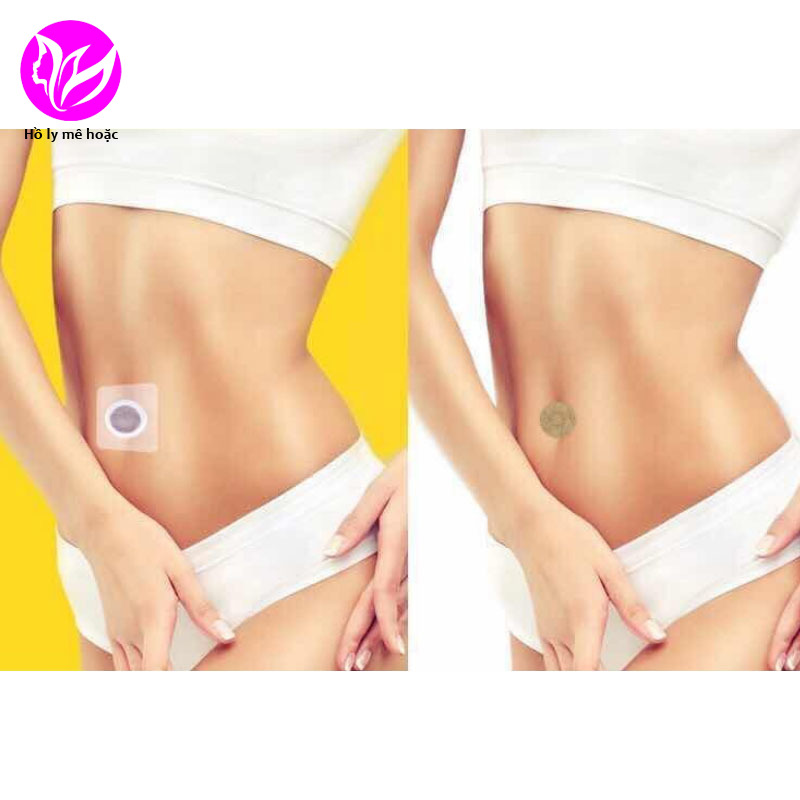 Hộp 10 Miếng Dán Rốn Tan Mỡ Trung Y Slimming Patch - Thảo Dược Nội địa Trung