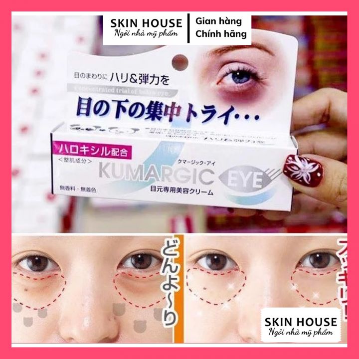 Kem mắt Kumargic Eye Nhật Bản -  Kem ngăn ngừa thâm quầng mắt Kumargic Eye Nhật Bản