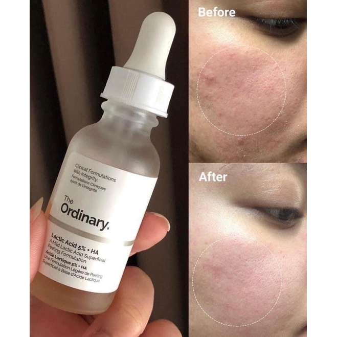 The Ordinary Serum Lactic Acid 5% 10% + HA The Ordinary - 30ml