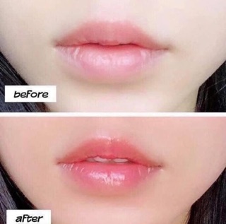 [Có Bill] Son Dưỡng Môi Carmex