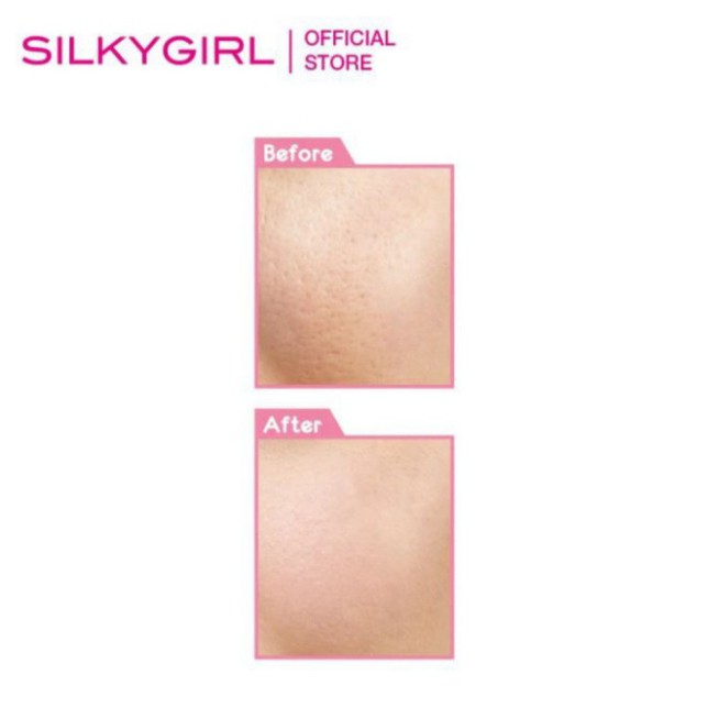 Kem Lót Trang Điểm Che Phủ Lỗ Chân Lông Cho Làn Da Mịn Màng Silkygirl Instant Pore Fix Primer 15ml Z13 | BigBuy360 - bigbuy360.vn