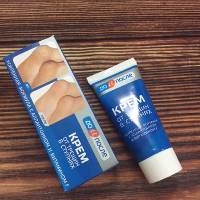 Kem trị nứt gót chân | BigBuy360 - bigbuy360.vn