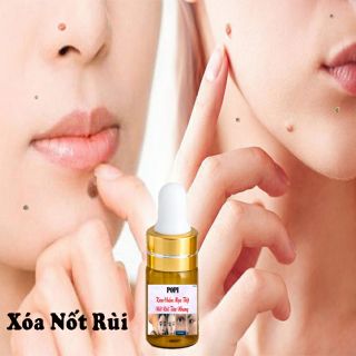 🌺Kem Xóa Nốt Ruồi