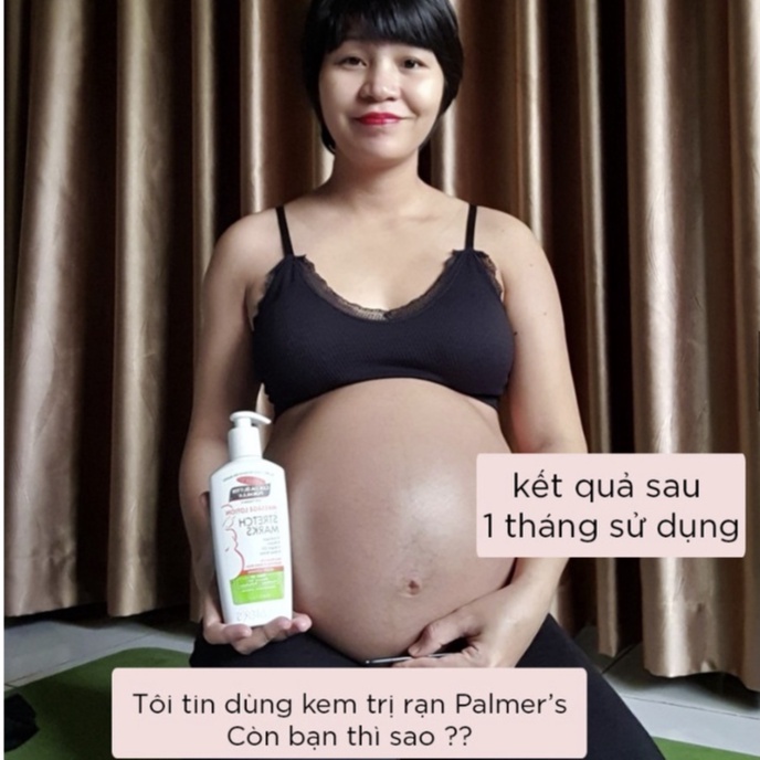 L.otion ngăn ngừa và làm giảm rạn da khi mang thai Palmer's 250ml 5422