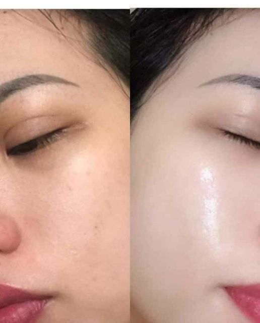 Ủ trắng kén tằm LSKIN WHITE | BigBuy360 - bigbuy360.vn