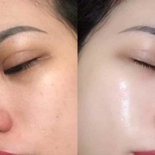 Ủ trắng kén tằm LSKIN WHITE
