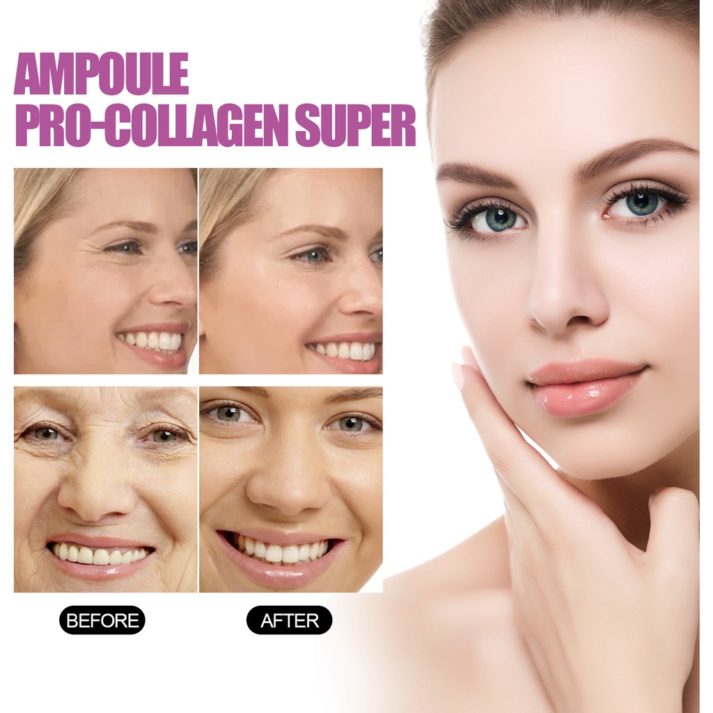 Serum Ceramide Chuyên Nghiệp Dưỡng Ẩm Chống Nếp Nhăn