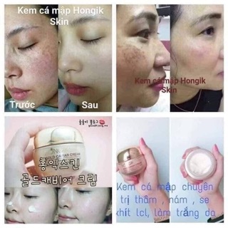 Kem cá mập