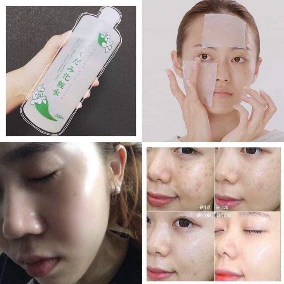 Nước hoa hồng lotion toner Dokudami  Tía tô / Diếp Cá 500ml Nhật Bản