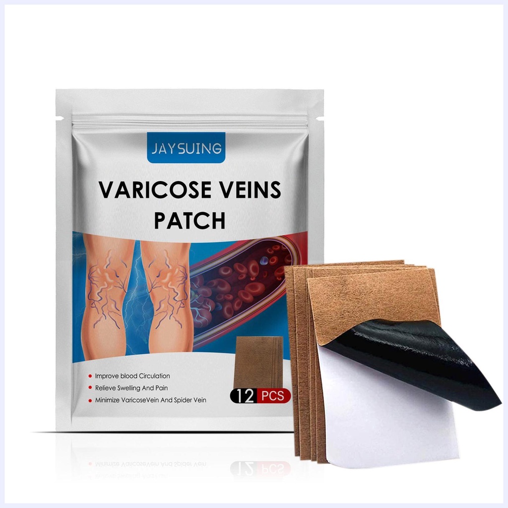 Bài chữa tĩnh mạch đăng giảm đau sưng chân giun đất chữa phình gân xanh chữa cao dán