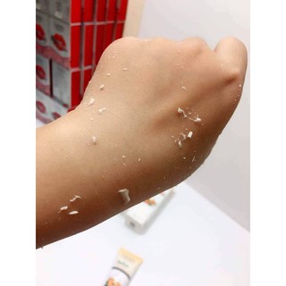 Tẩy tế bào chết